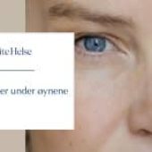 Mørke ringer under øynene – Hvorfor du kan se trøtt ut – selv når du ikke er det