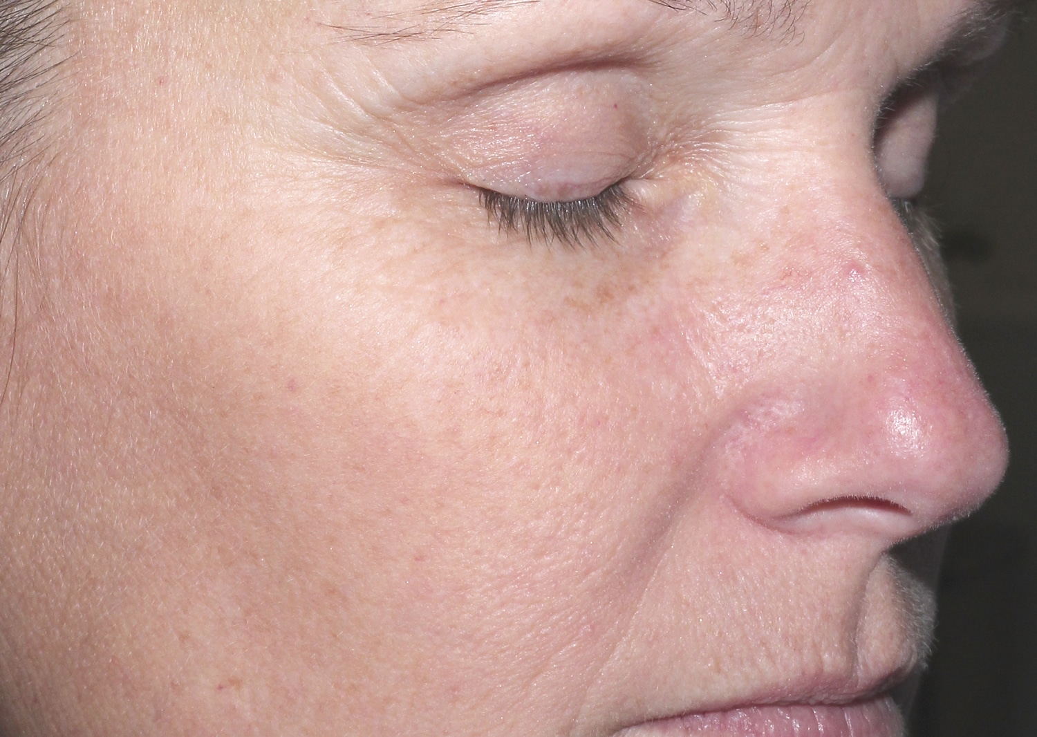 After treatment picture - The-Age-well-Program