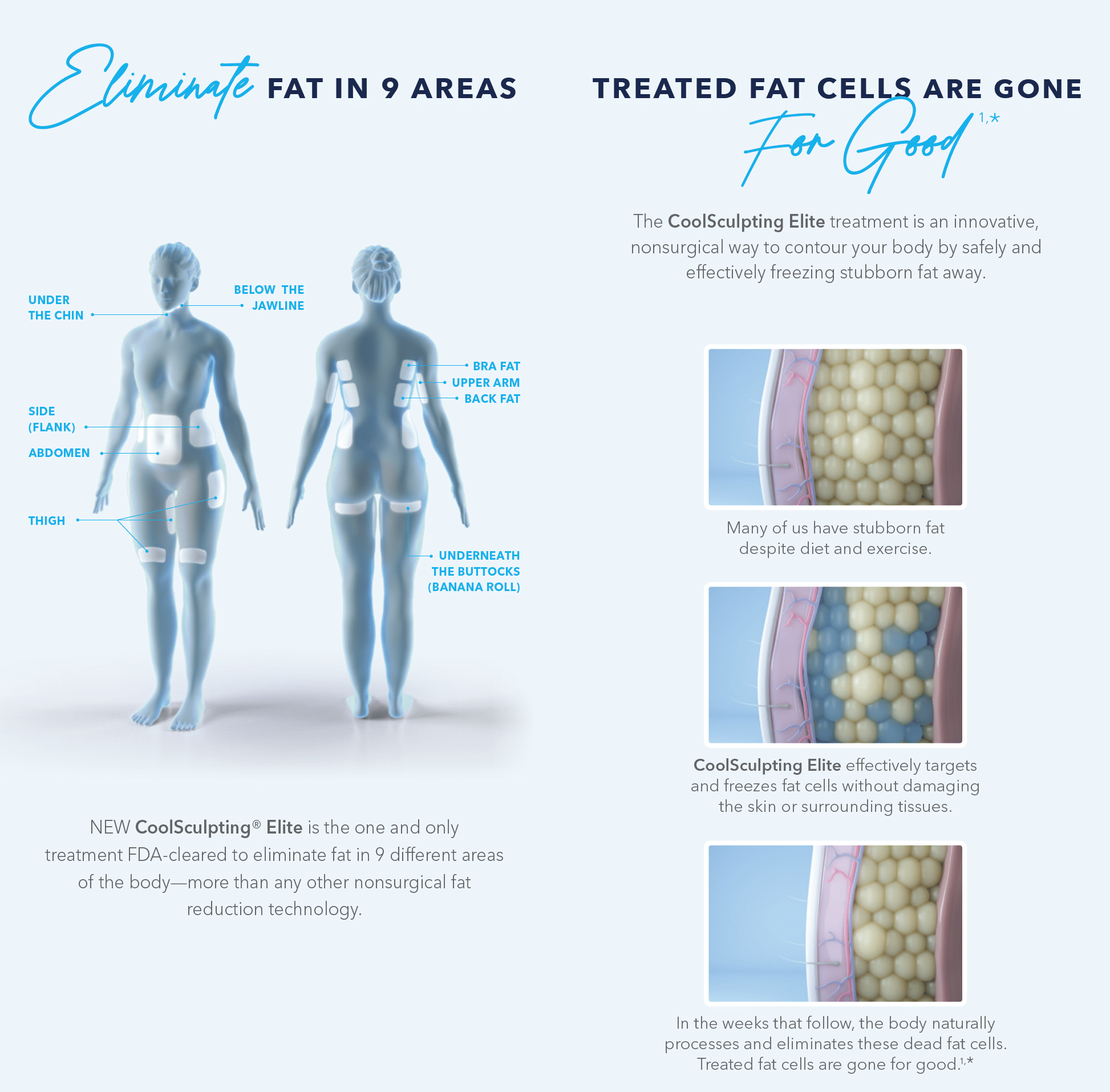 CoolSculpting elite eliminate fat cells