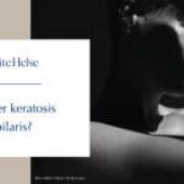 Har du små røde nupper og tørr hud? Slik blir du kvitt keratosis pilaris i sommer.