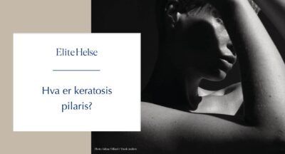 Har du små røde nupper og tørr hud? Slik blir du kvitt keratosis pilaris i sommer.
