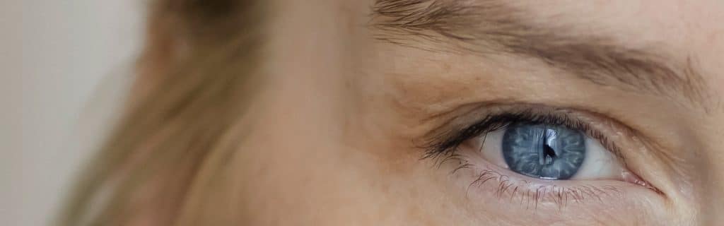 Øvre øyelokksplastikk