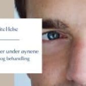 Mørke ringer under øynene