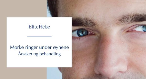 Mørke ringer under øynene