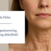 Hudoppstramming av hals og dekolletér